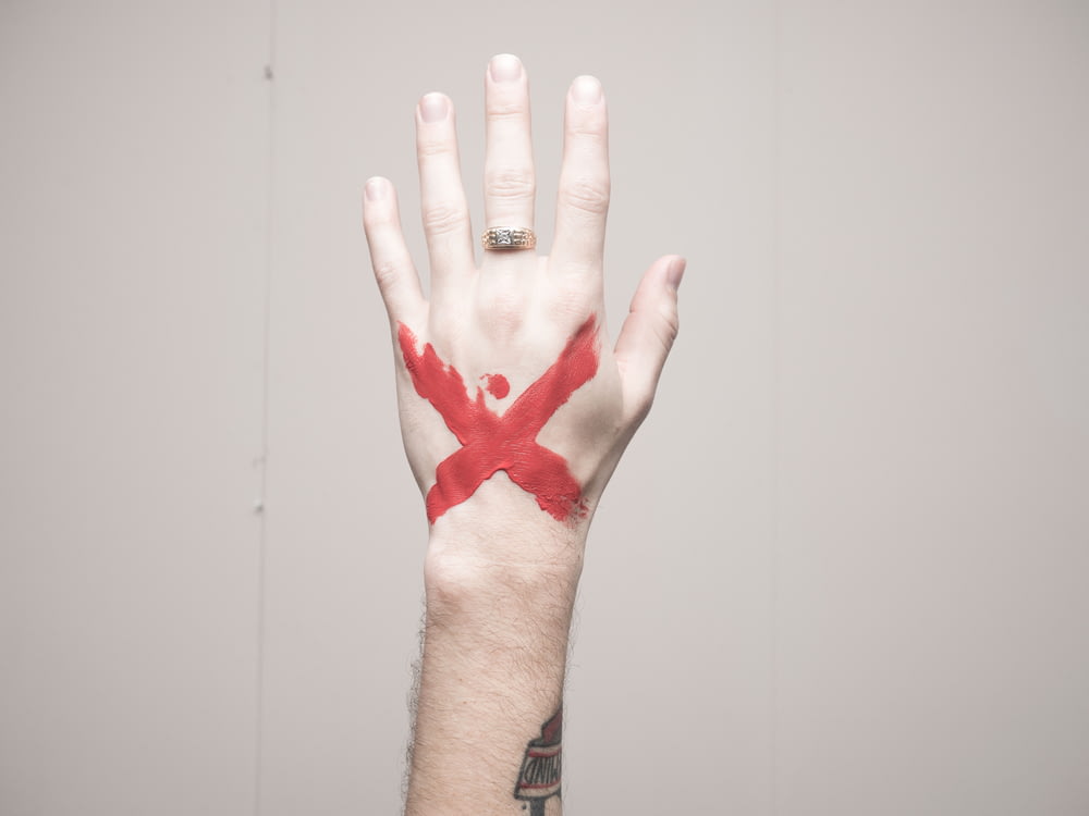 left human hand with x mark