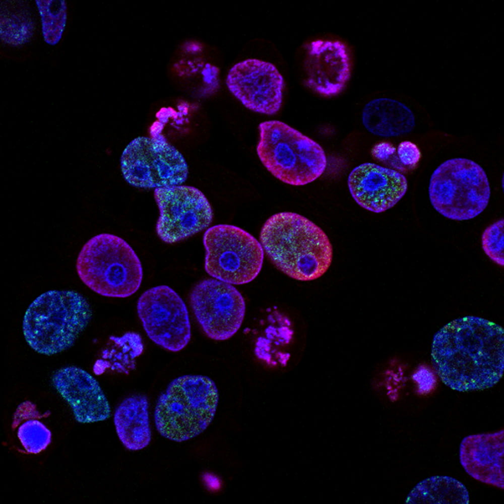 Violette Zellen