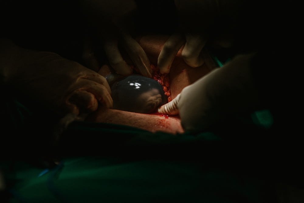 a person is performing surgery in a dark room