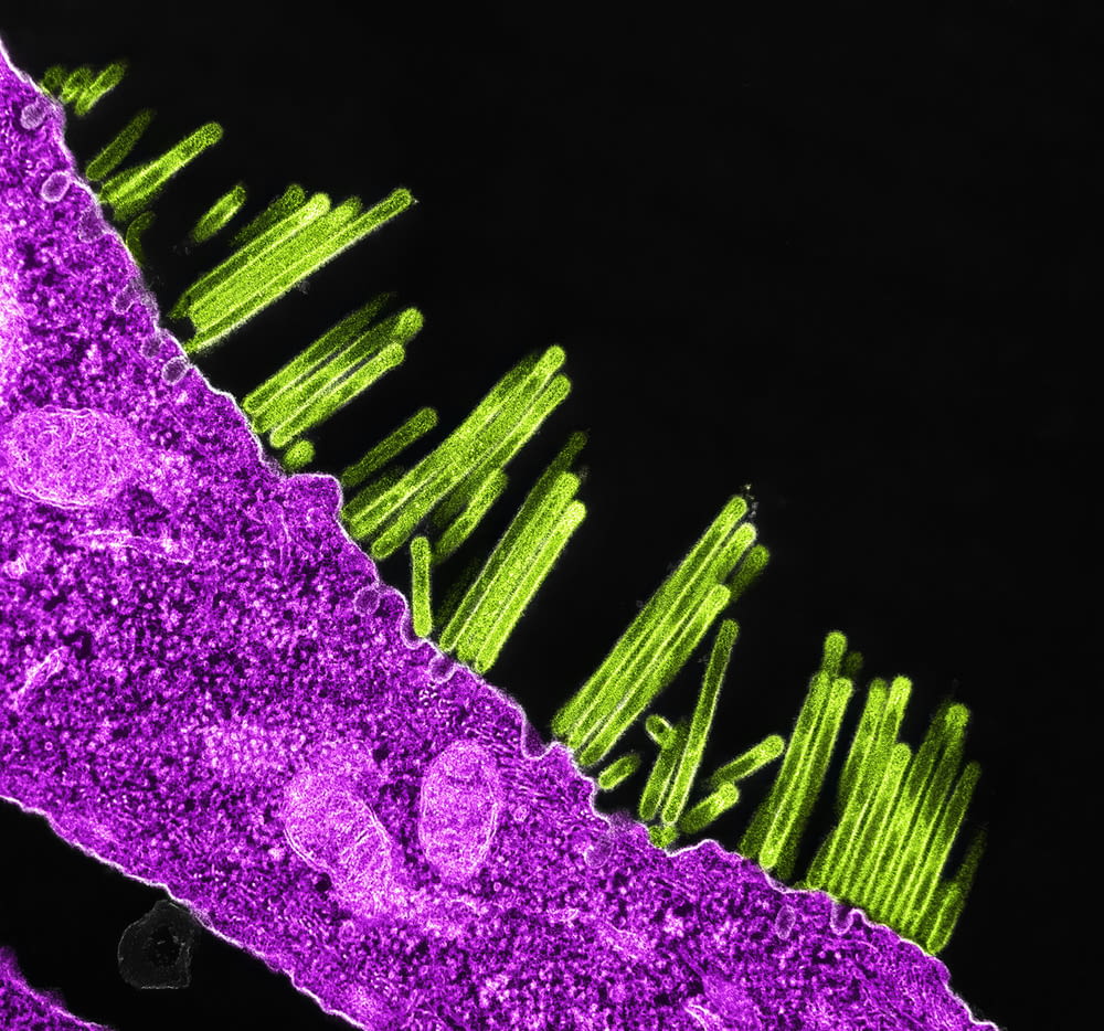 an image of a purple and green cell