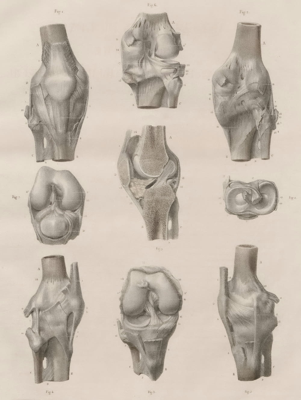 다양한 유형의 뼈 그림