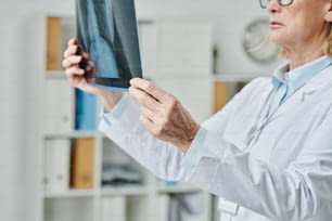 Mãos de radiologista maduro em jaleco branco tentando estabelecer o diagnóstico para o paciente enquanto olha para a imagem de raios-x dos pulmões em clínicas
