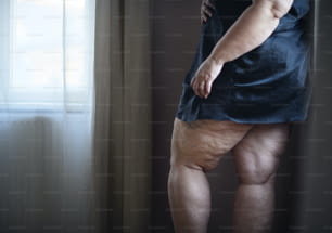 A fat woman with cellulite on her legs, cut out.