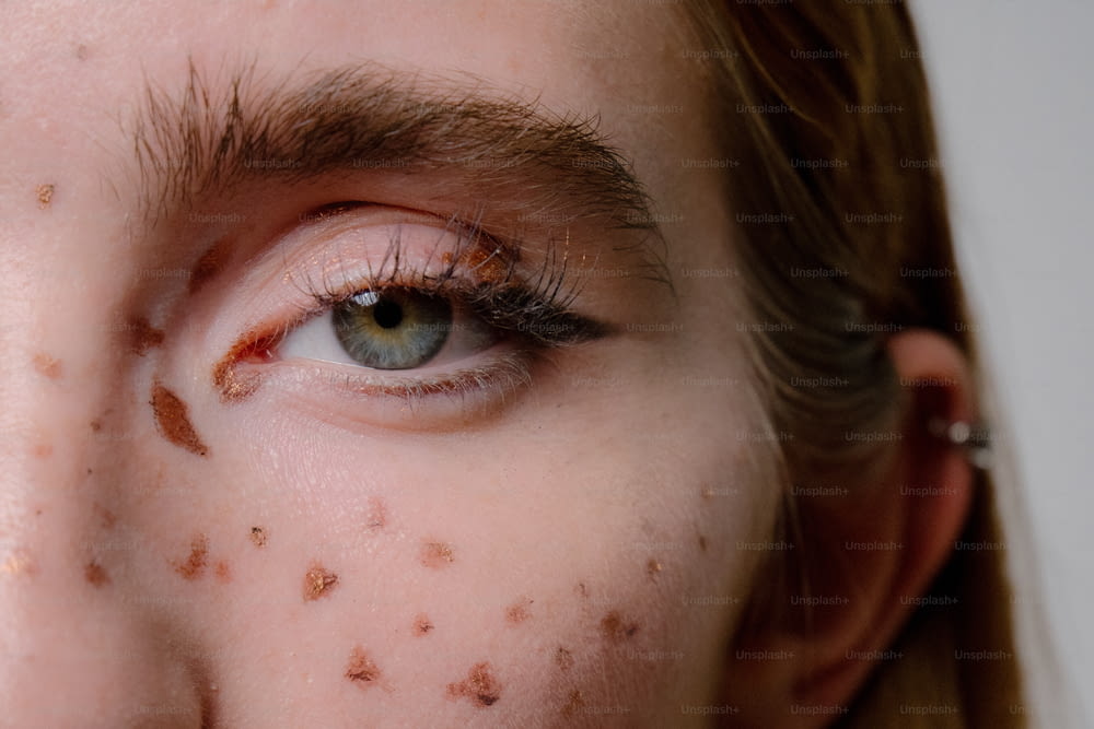 a close up of a person with brown spots on their face