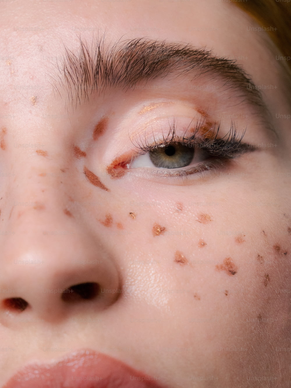 Eine Nahaufnahme einer Frau mit Akne im Gesicht