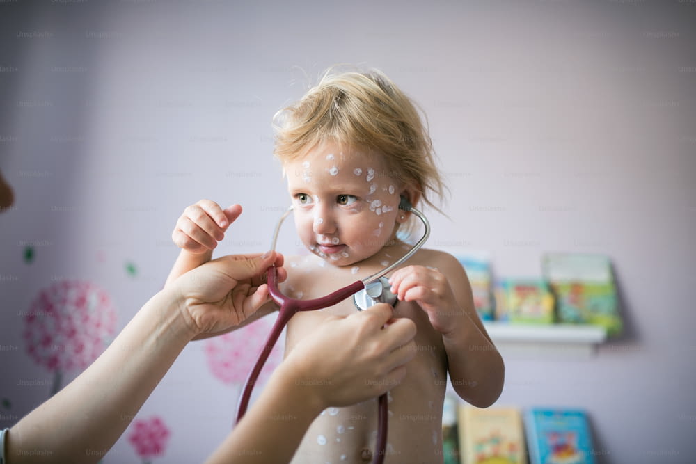 Little two year old girl at home sick with chickenpox, white antiseptic cream applied to the rash. Mother giving her stethoscope.