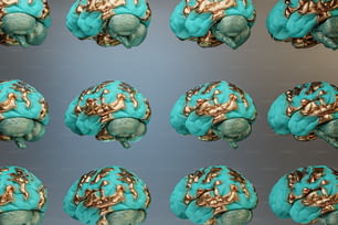 a series of images of a human's brain