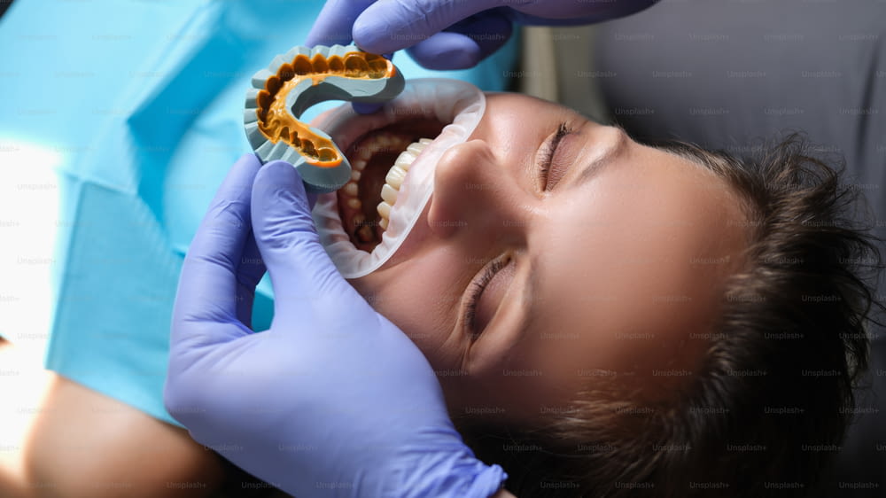 석고 모델의 인공 치아 시뮬레이션과 치과 진료 시 입을 벌린 환자. 베니어 개념을위한 턱 준비