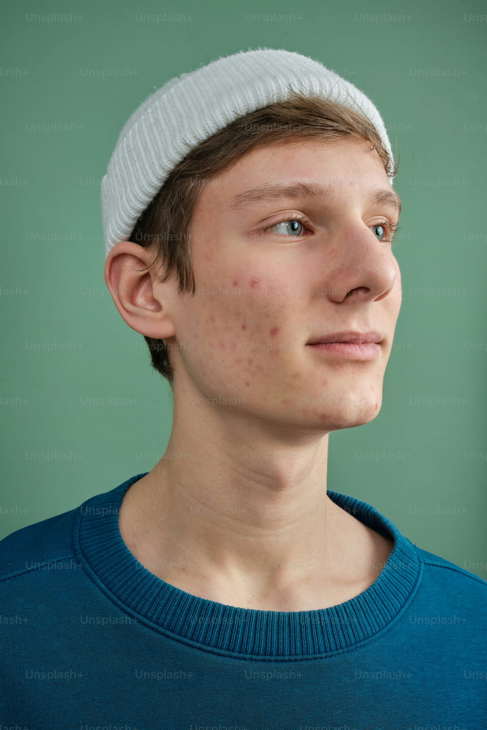a young man with freckled hair wearing a hat